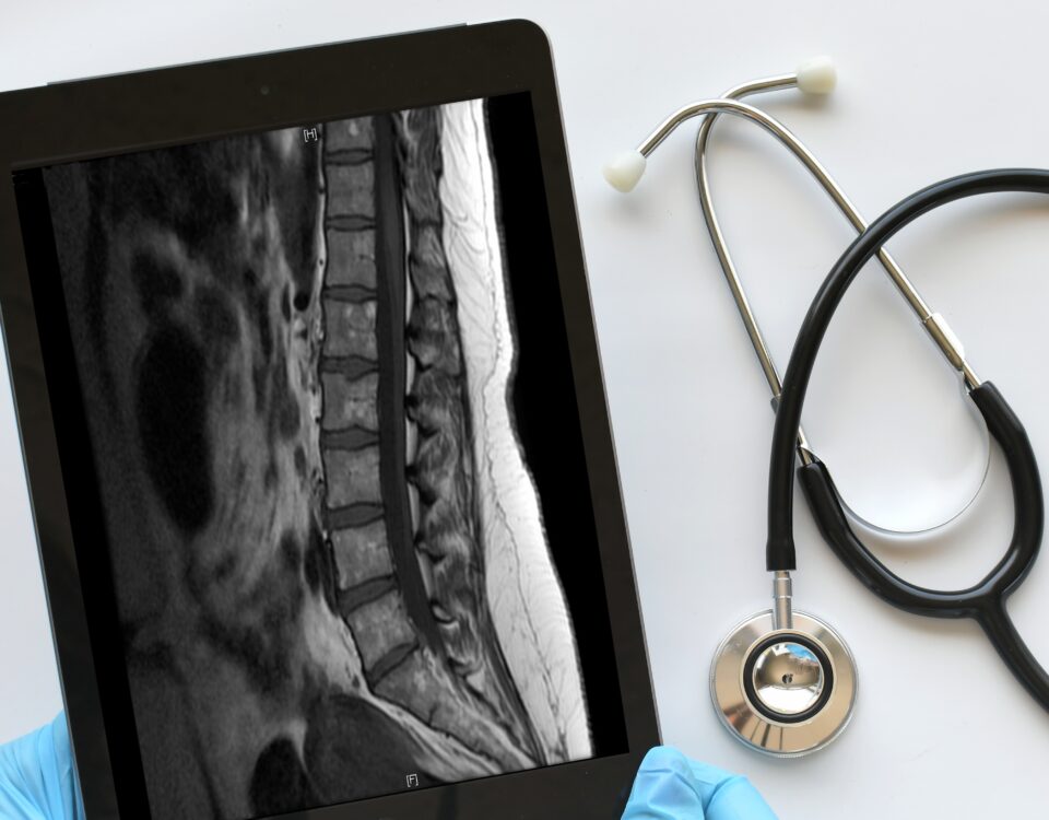Doctor, medical professional technician using a ipad tablet to view read MRI results
